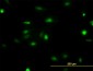 NEK2 Antibody (monoclonal) (M11)